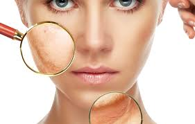 Hormonal Imbalances lead to many skin related problems